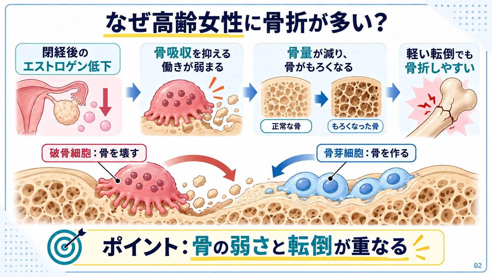 大腿骨近位部骨折の背景:エストロゲン低下、破骨細胞と骨芽細胞のはたらき、骨がもろくなる流れ