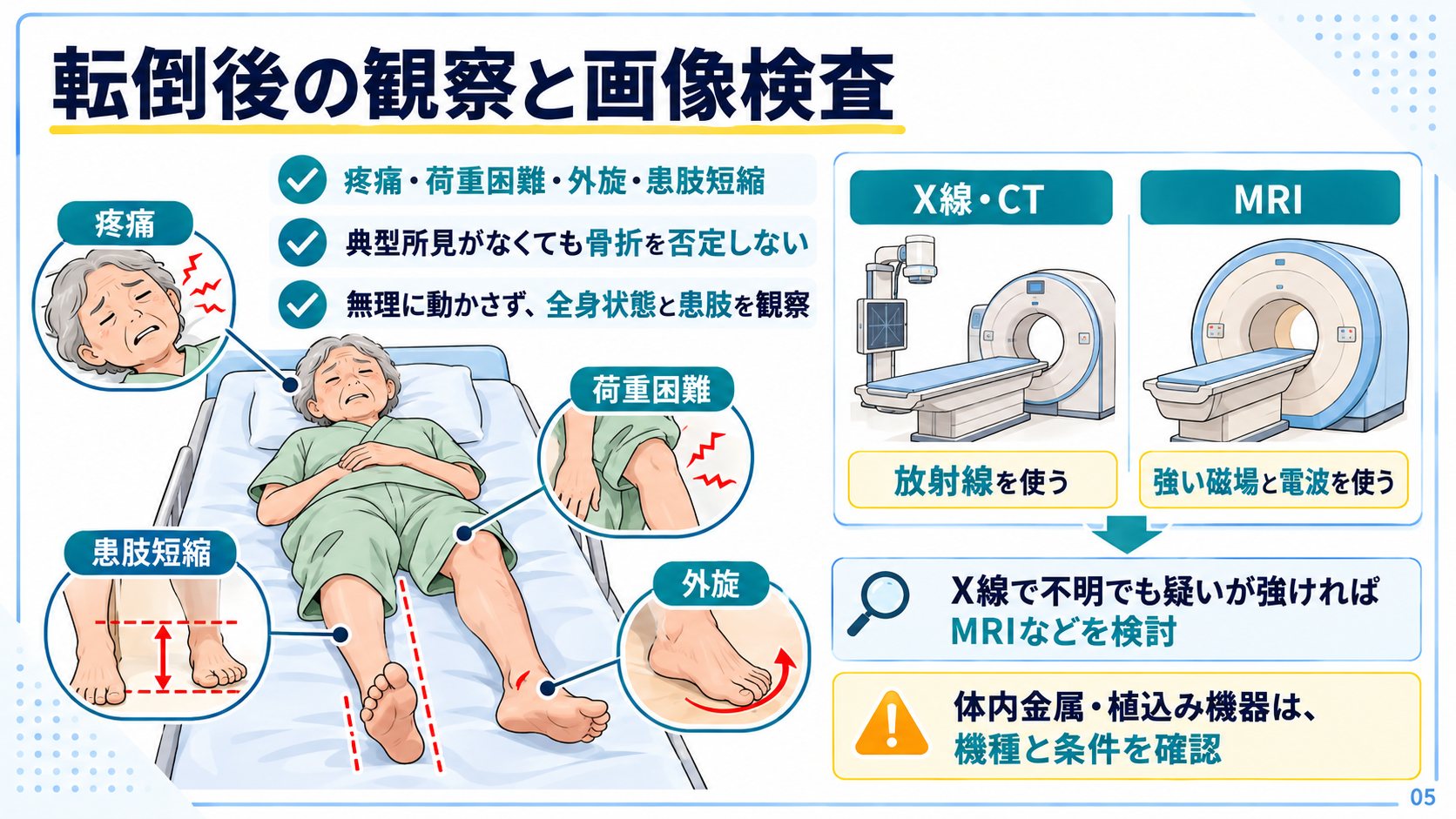転倒後の観察:疼痛・荷重困難・外旋・患肢短縮と、X線・CT・MRIの検査の流れ
