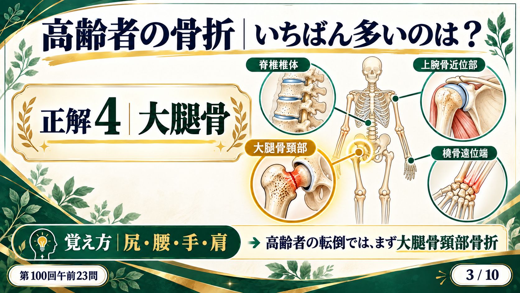 高齢者の骨折：いちばん多いのは大腿骨（大腿骨頚部・脊椎椎体・上腕骨近位部・橈骨遠位端）