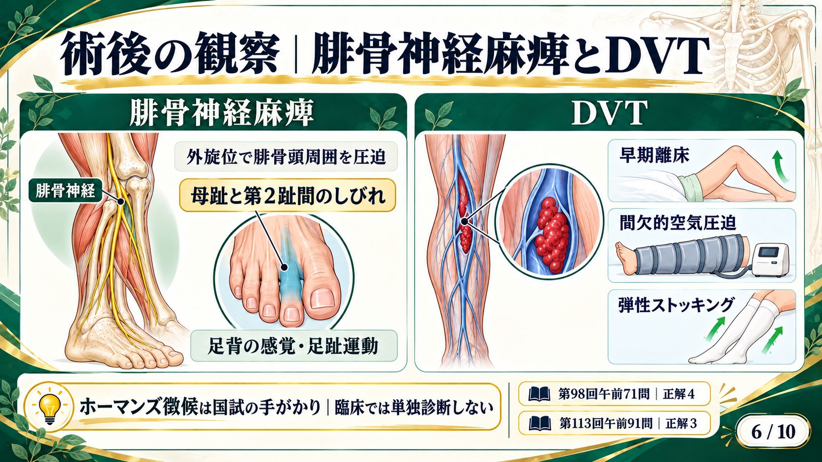 術後の観察：腓骨神経麻痺とDVT